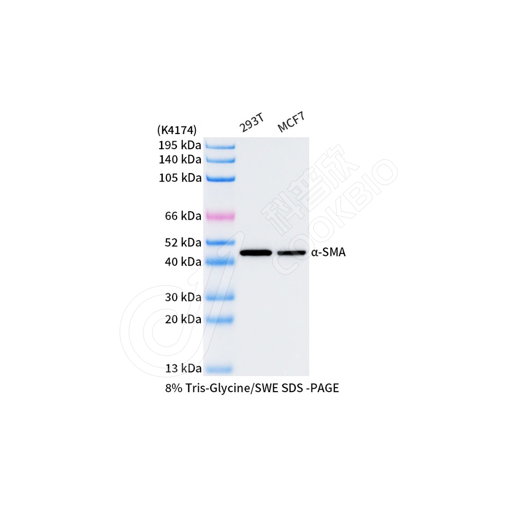 01WB1 K1334092_alpha smooth muscle Actin_d1000_WB.jpg
