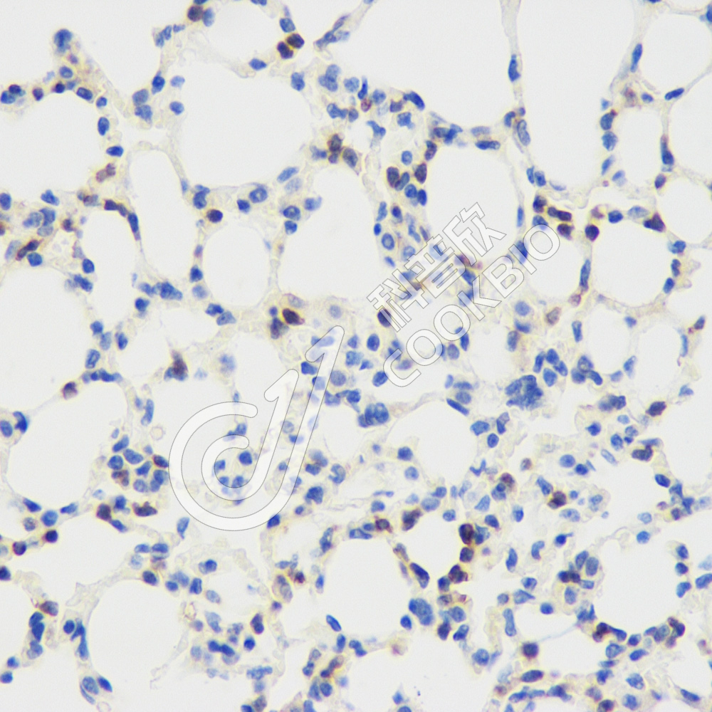 1 K133198_CD45_S45822051701_d2500_M lung_40x_IHC.jpg