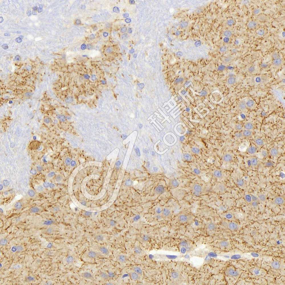 2 K133114-1_ACHE_26417011102_d1200_R brain_40.0x_IHC.jpg