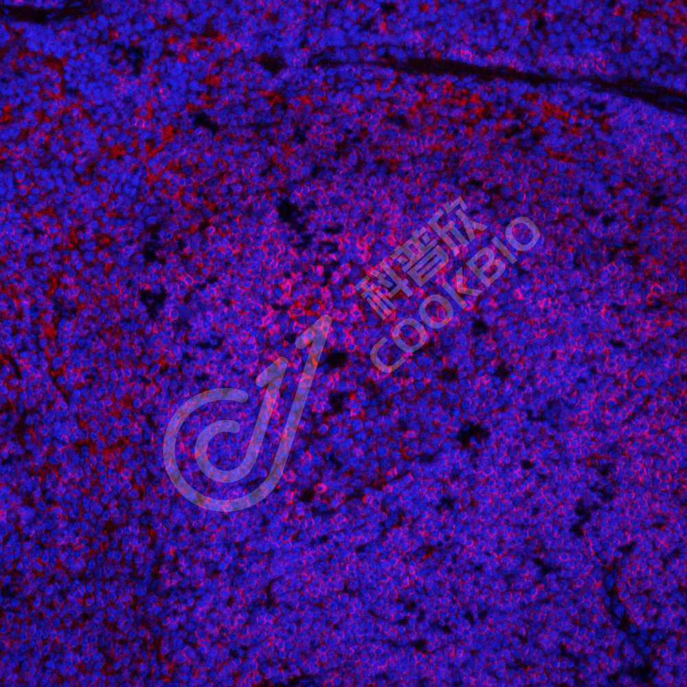 2 K133198_CD45_red_S45822051701_d2500_M spleen_20x_IF.jpg