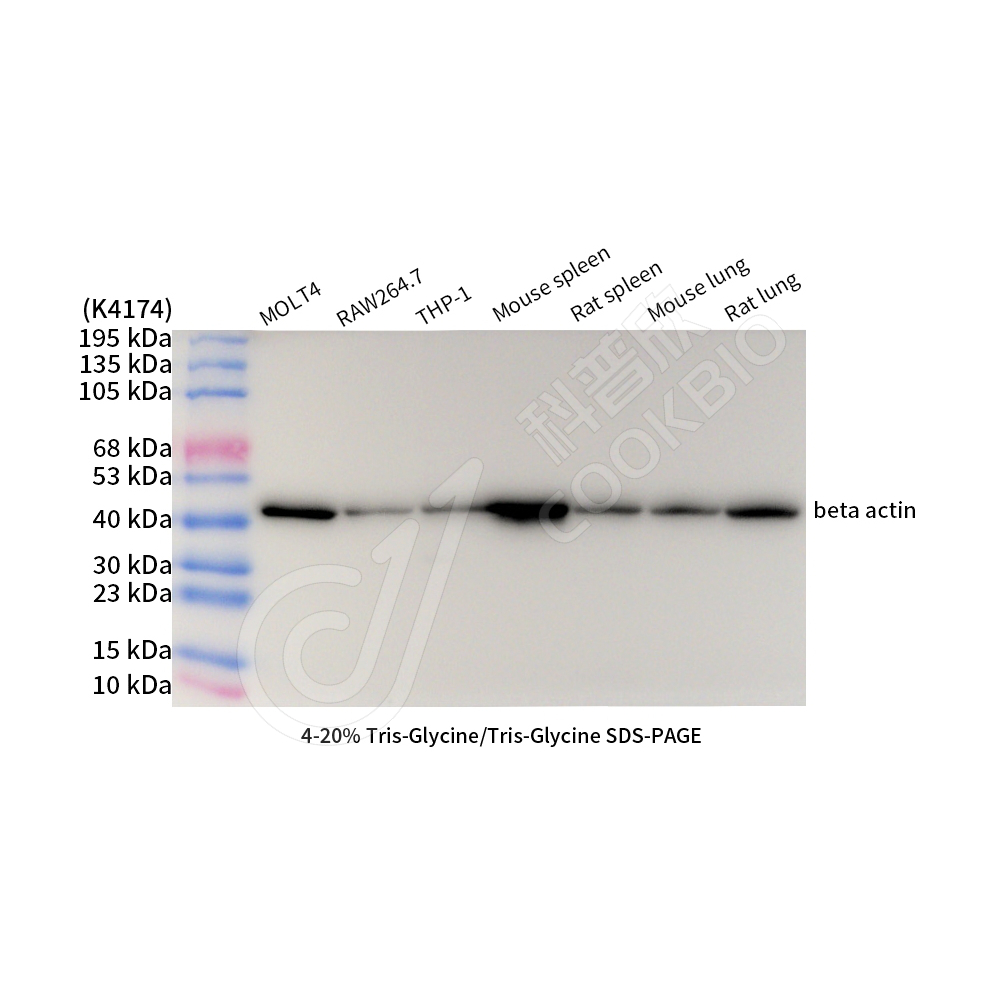 K545003_beta actin_d2000_WB.jpg