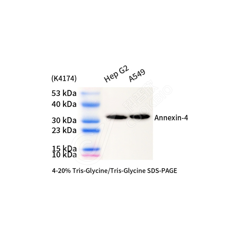 Annexin-4_d1000_WB