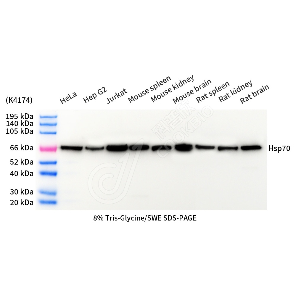 Hsp70_d1000_WB
