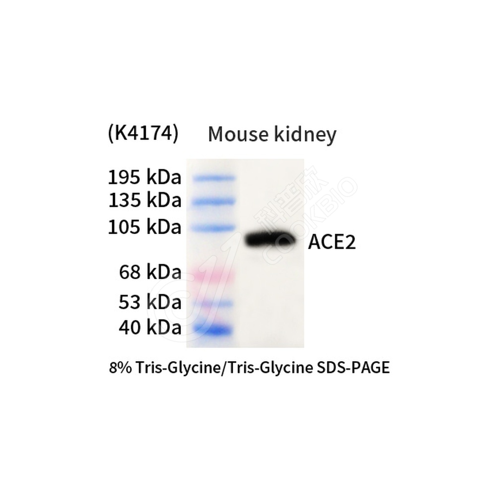 Angiotensin Converting Enzyme 2_d500_WB