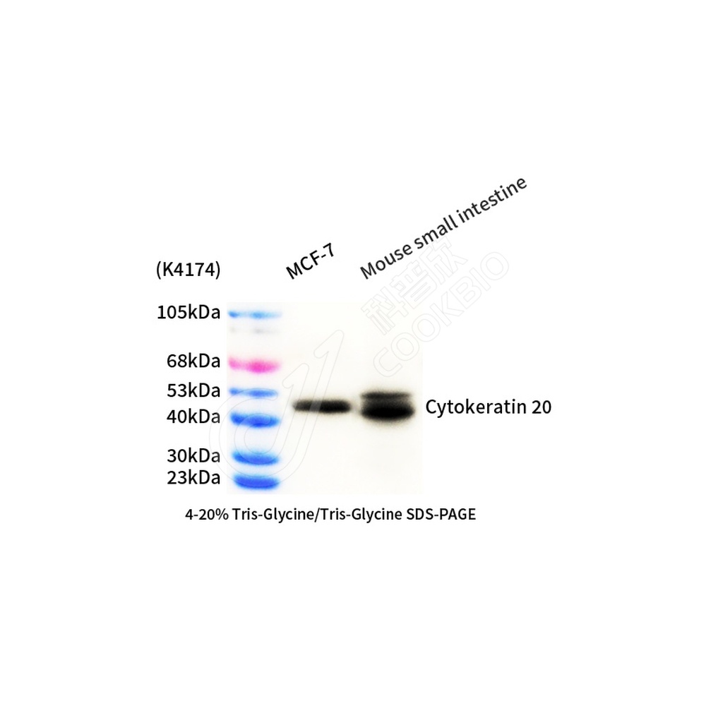 Cytokeratin 20_d1000_WB