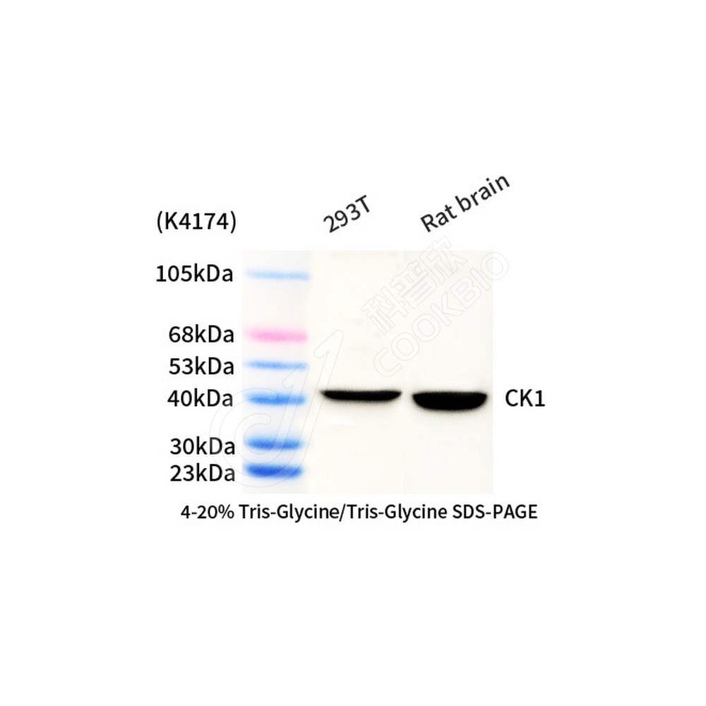 CK1 epsilon_d1000_WB