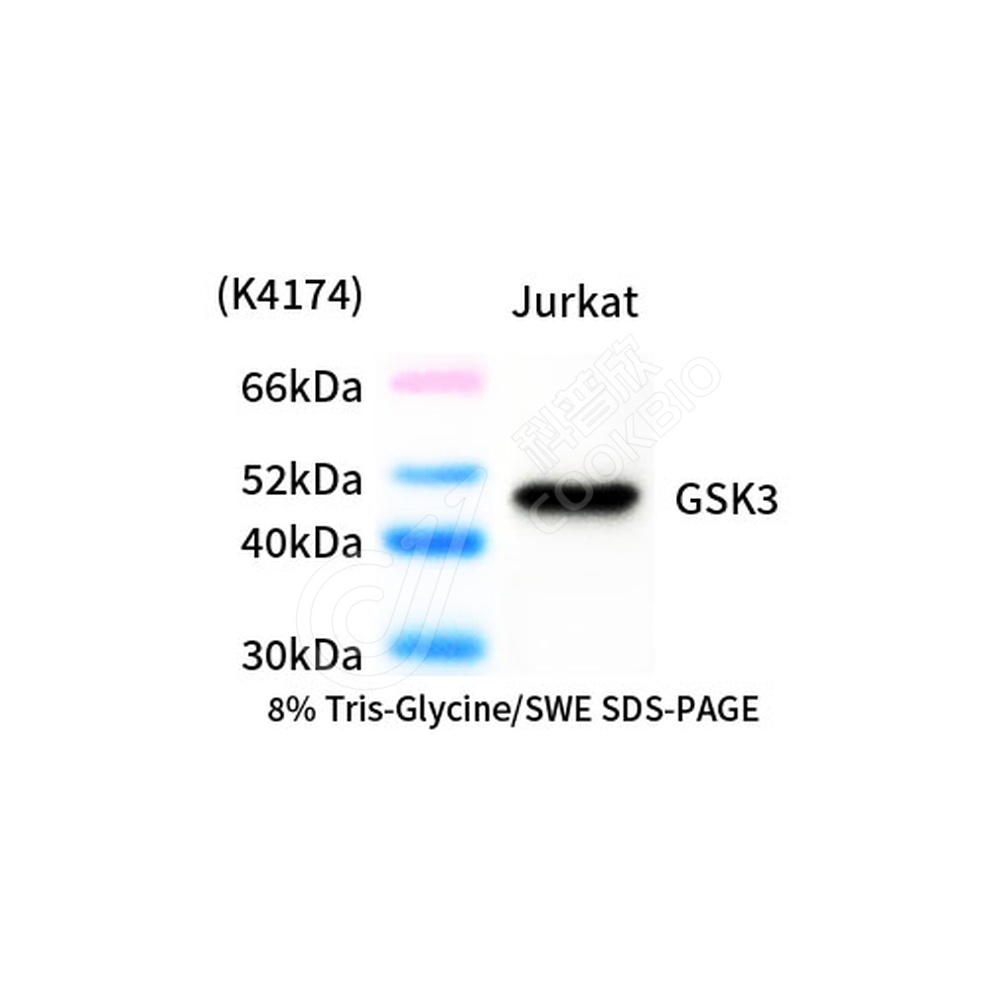 GSK3 beta_d1000_WB