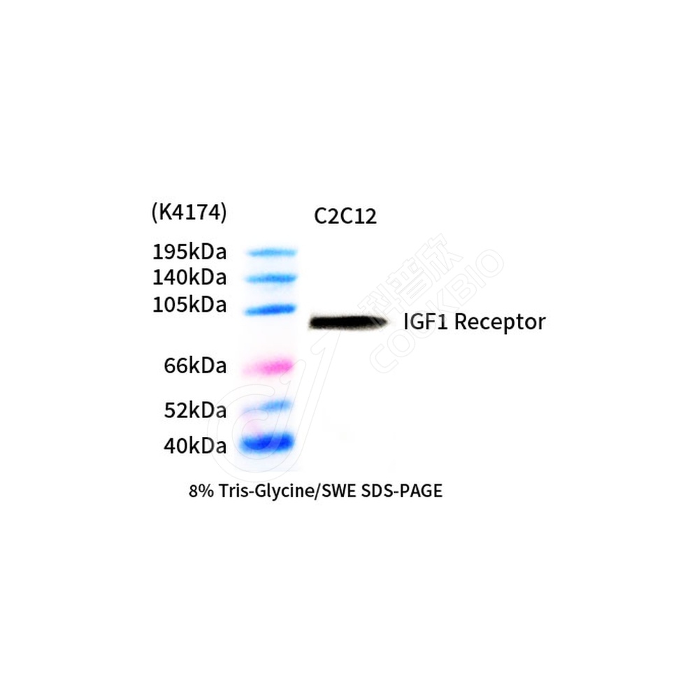 IGF1 Receptor_d1000_WB