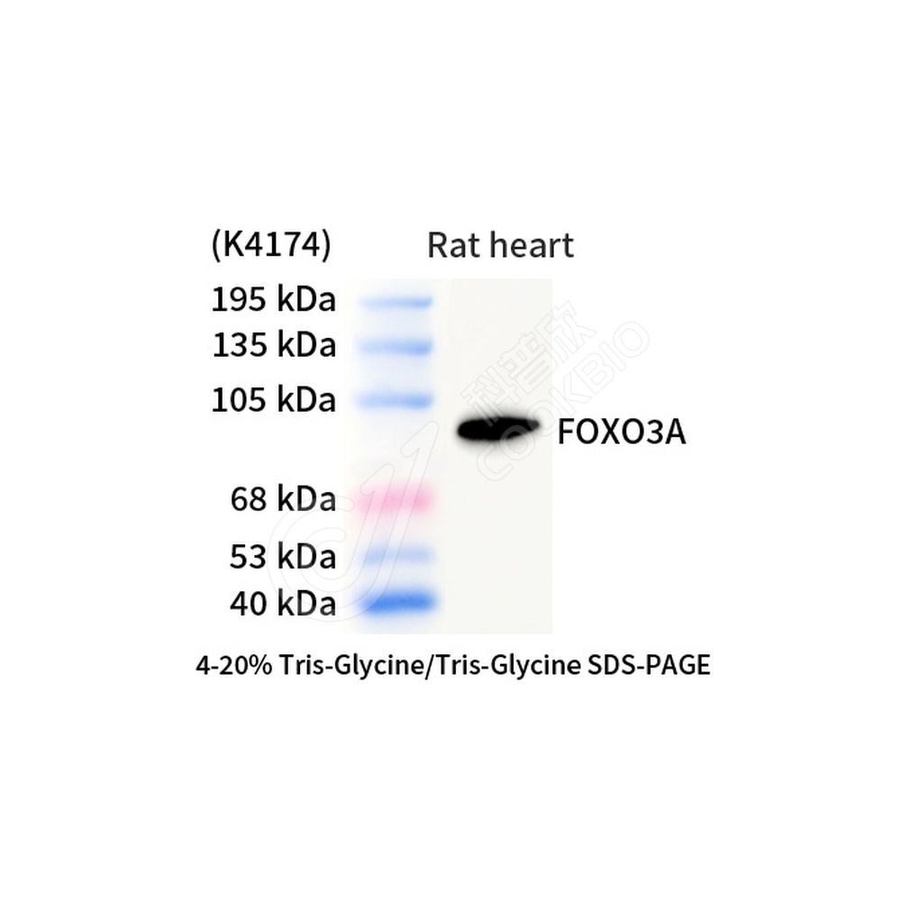FOXO3A_d1000_WB