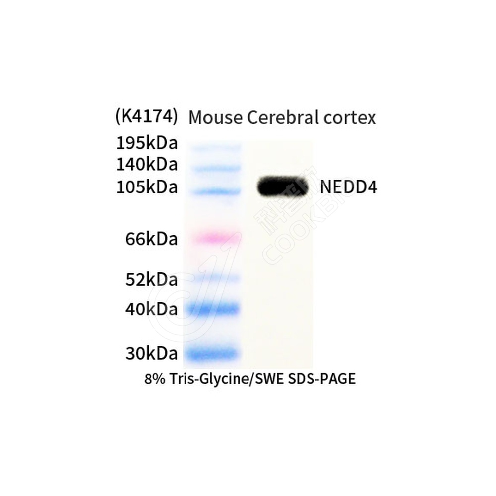 NEDD4_d1000_WB