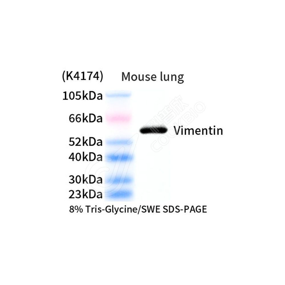 Vimentin_d1000_WB
