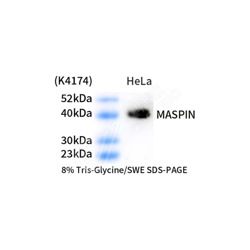 MASPIN_d1000_WB