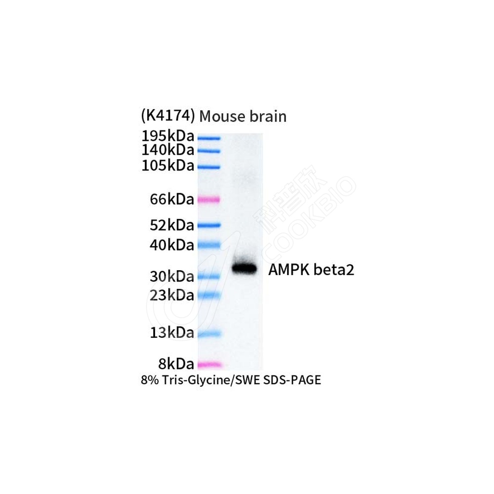AMPK beta2_WB