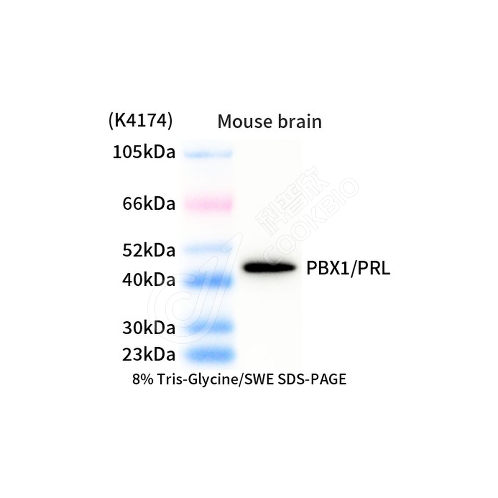 PBX1_d1000_WB