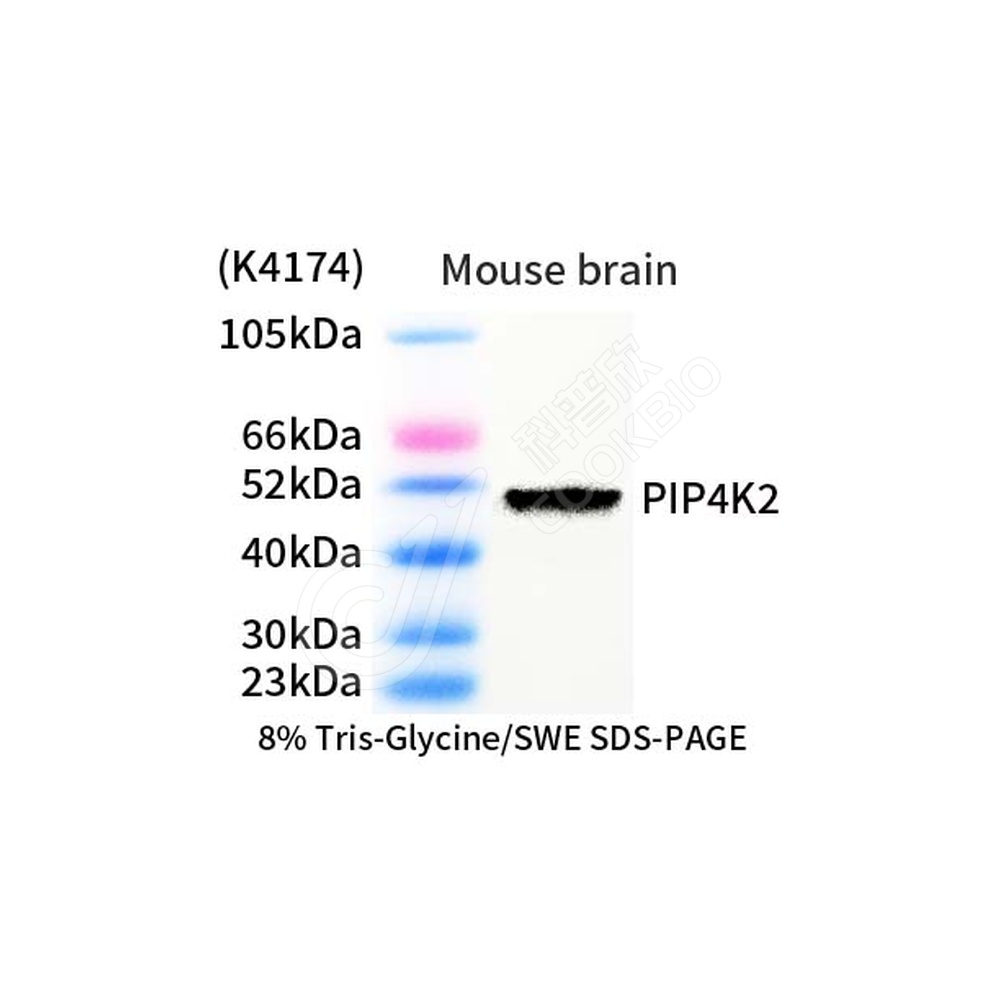 PIP4K2_d1000_WB