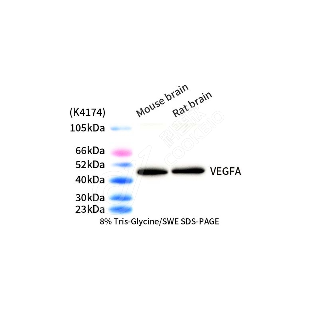 VEGFA_d1000_WB