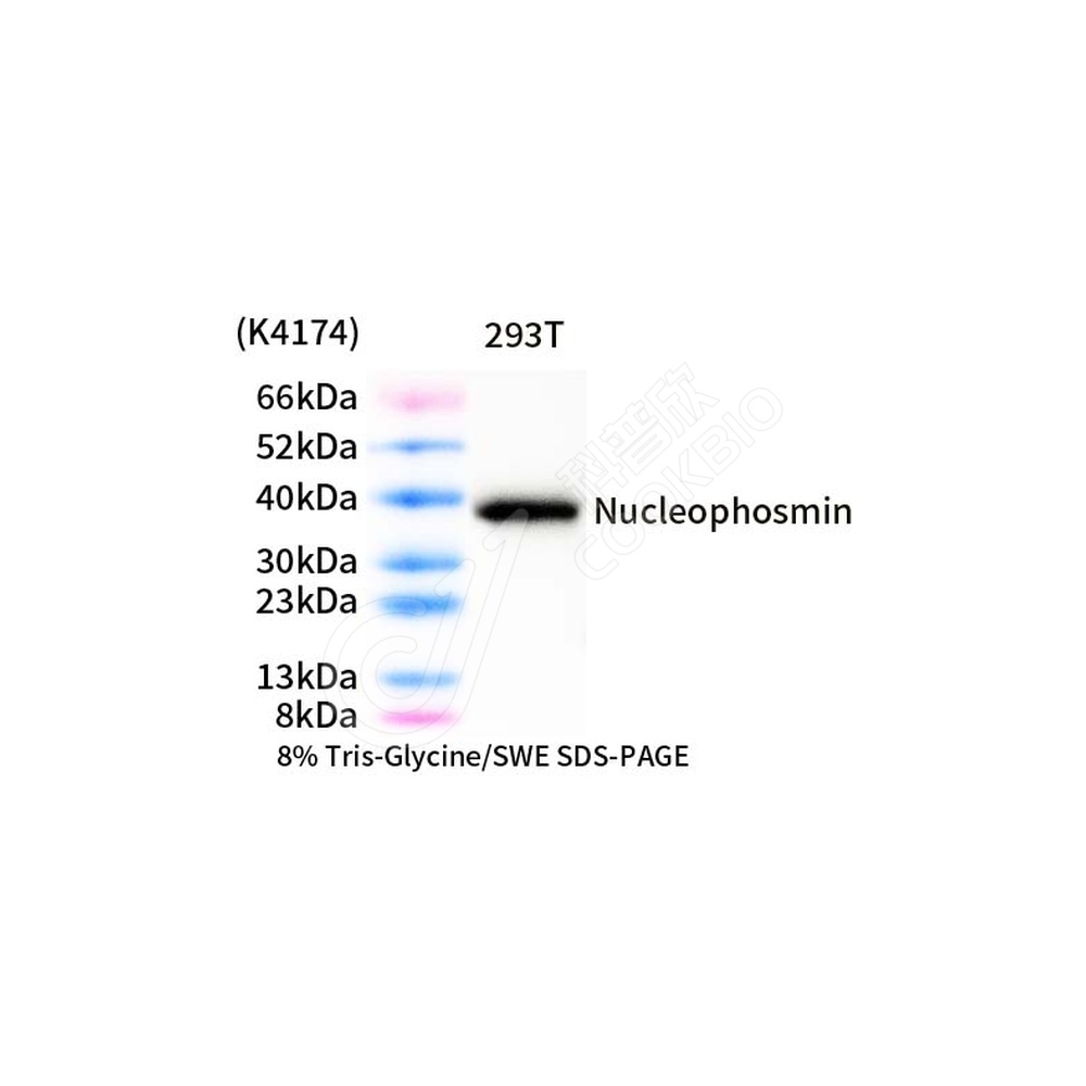 Nucleophosmin_d1000_WB-1
