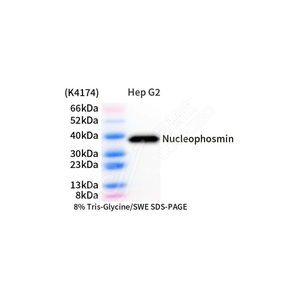 Nucleophosmin_d1000_WB-2