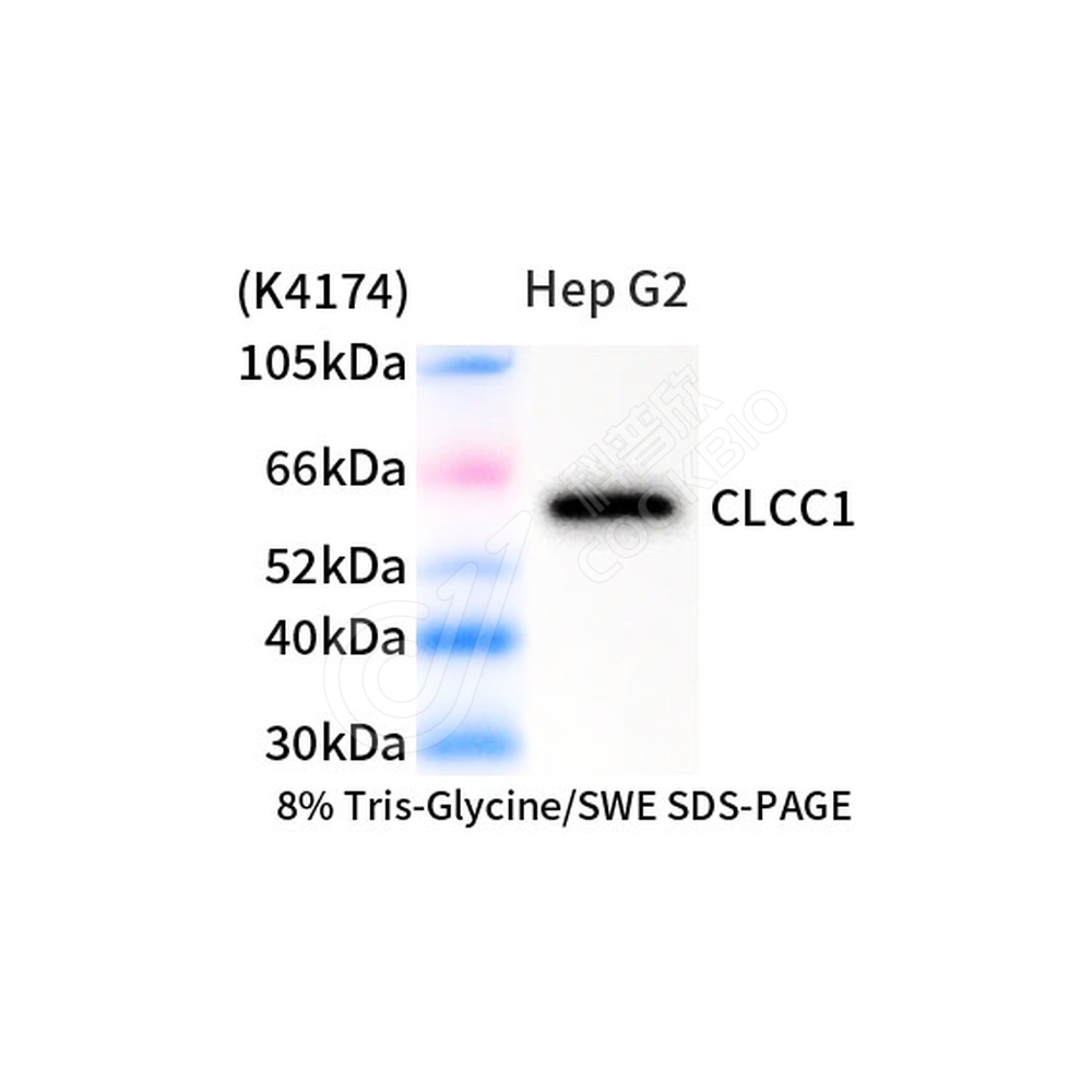 CLCC1_d1000_WB