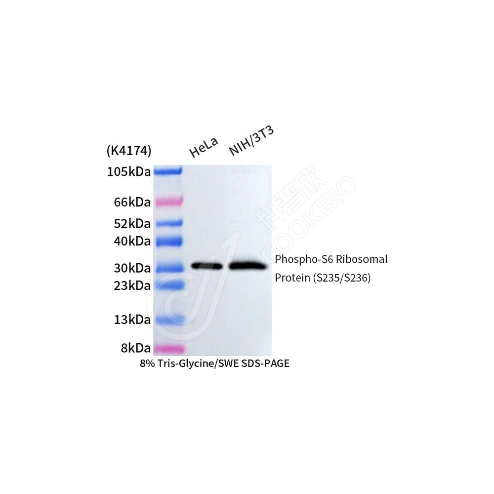 P-S6 Ribosomal_WB