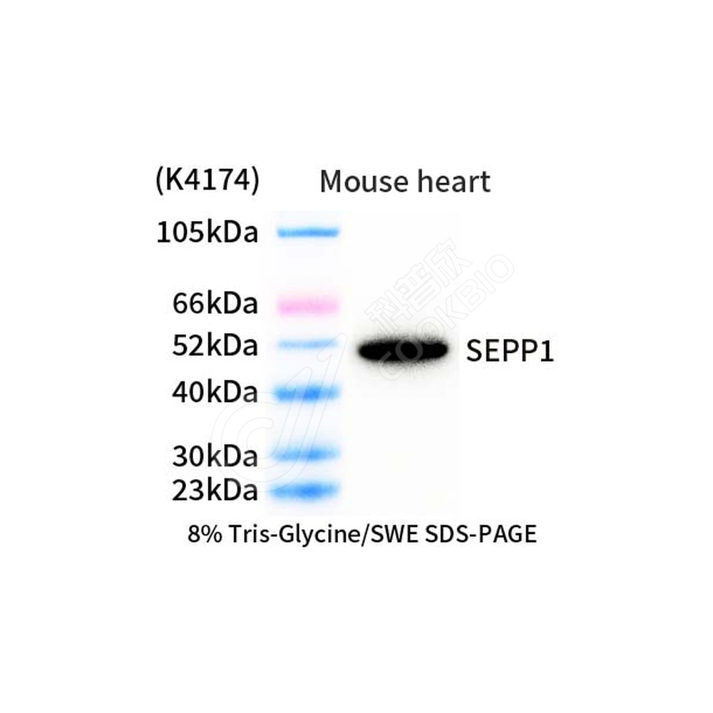 SEPP1_d1000_WB