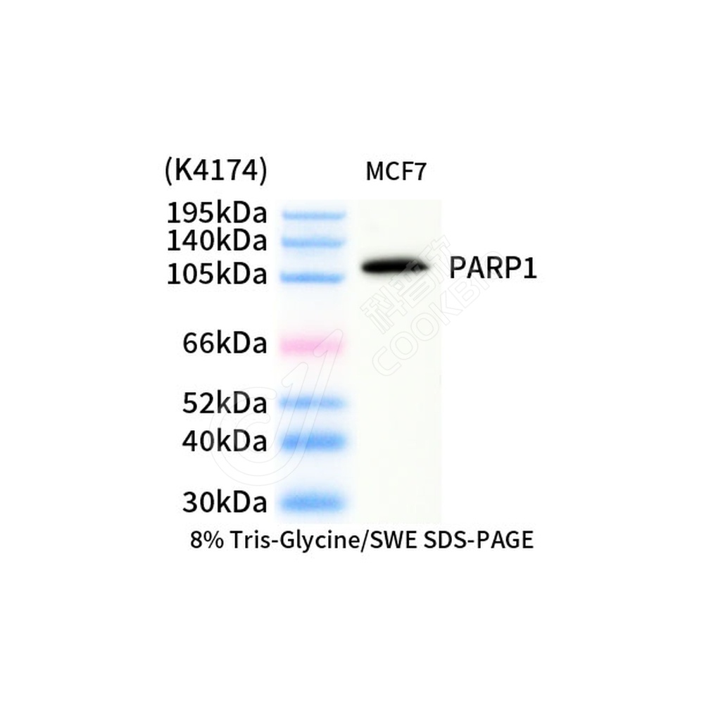 PARP1_d1000_WB