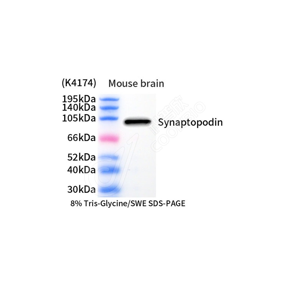 Synaptopodin_d1000_WB