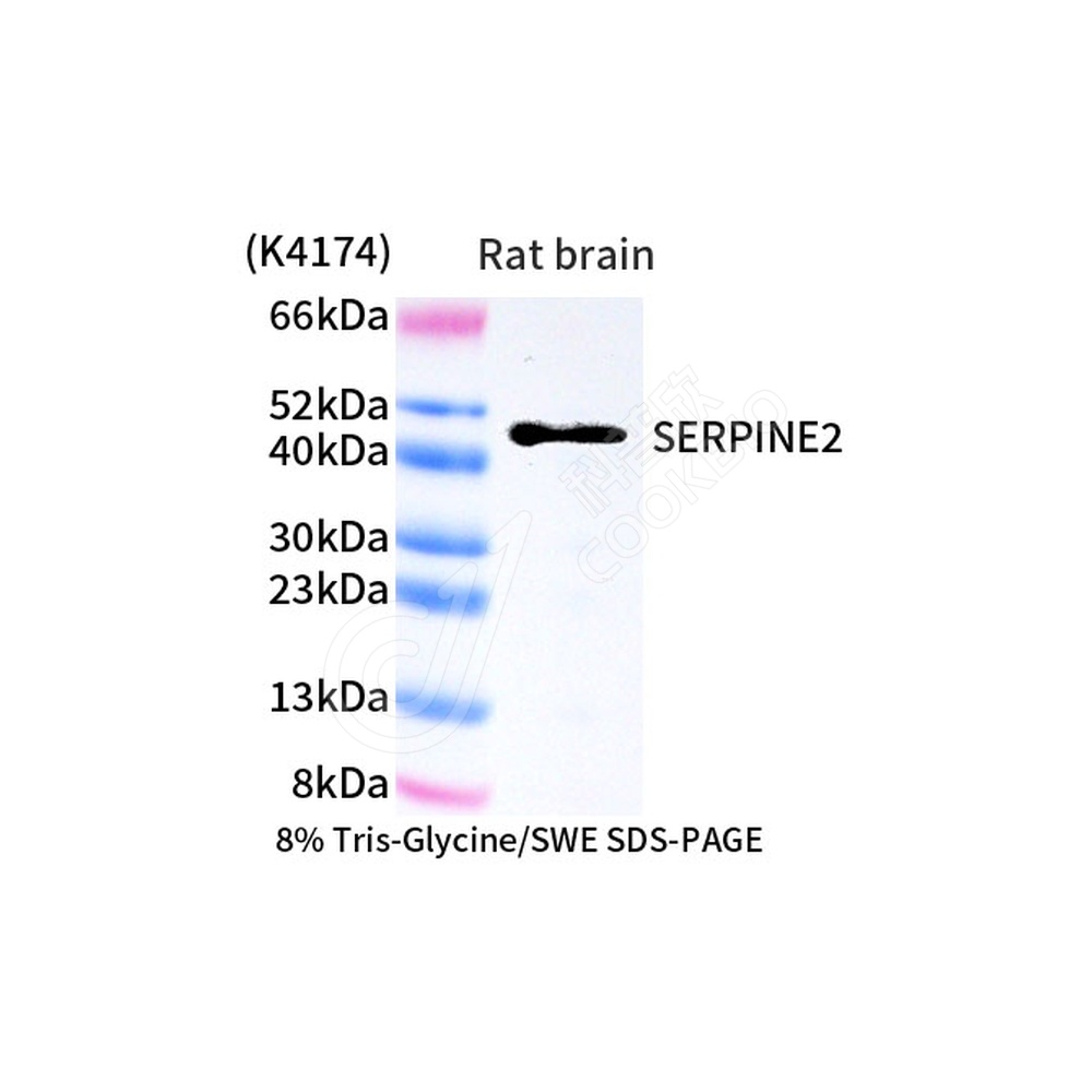 SERPINE2_WB