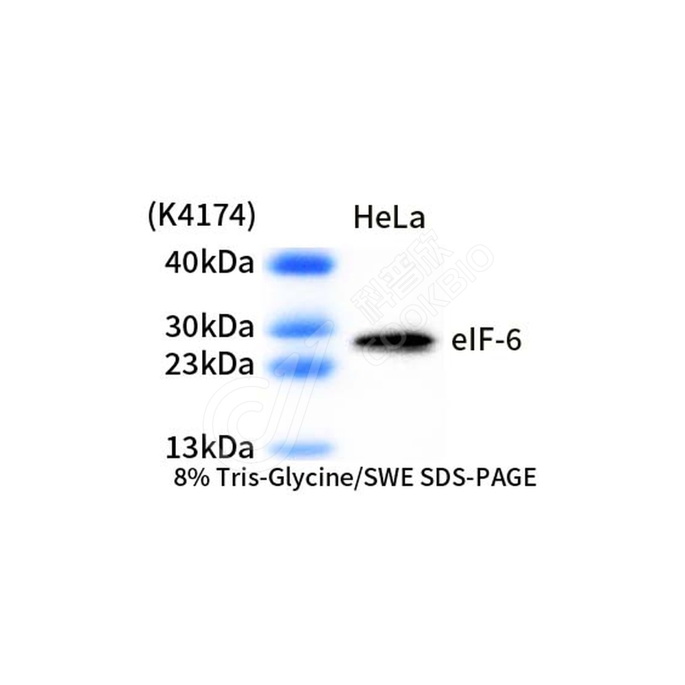 eIF-6_d1000_WB
