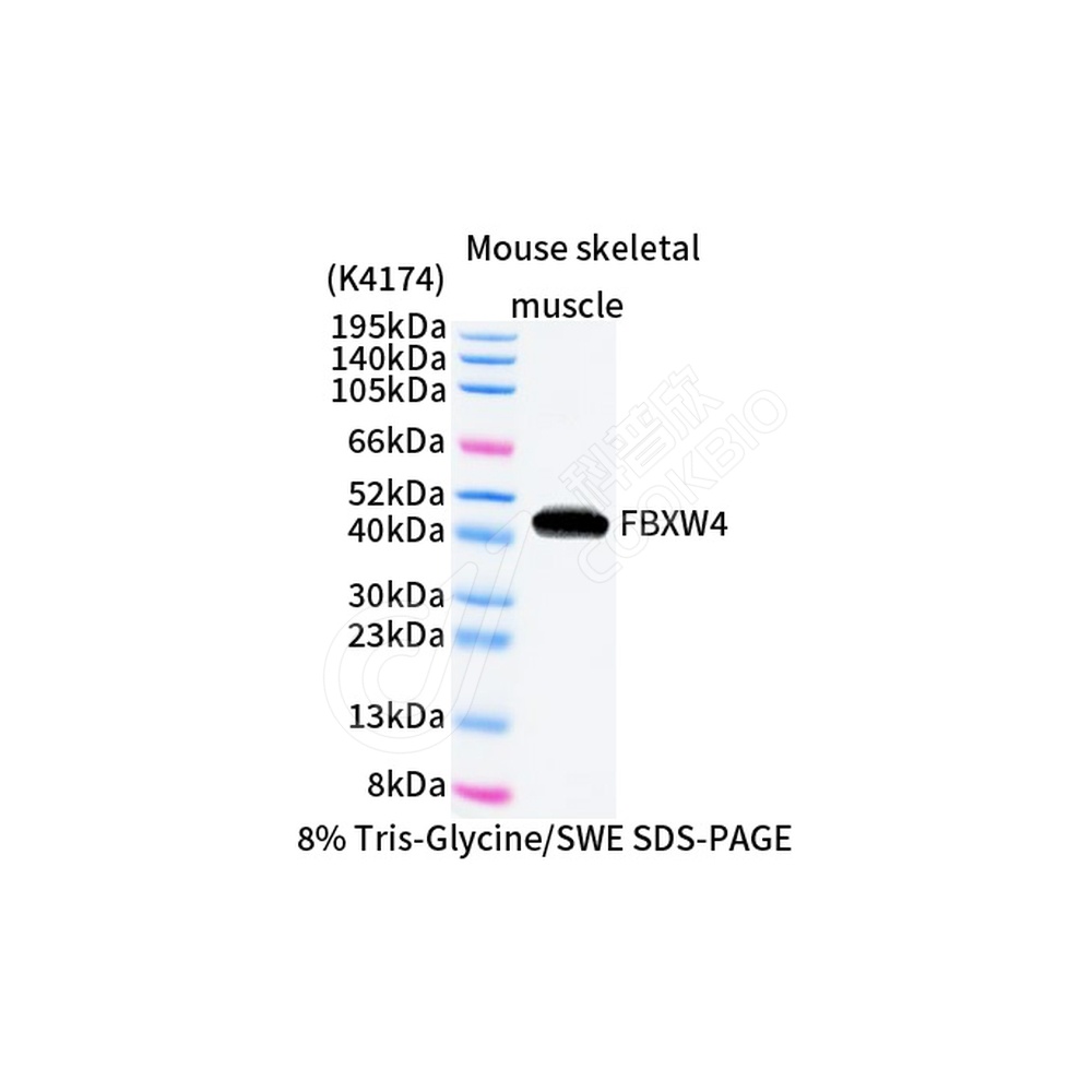 FBXW4_WB