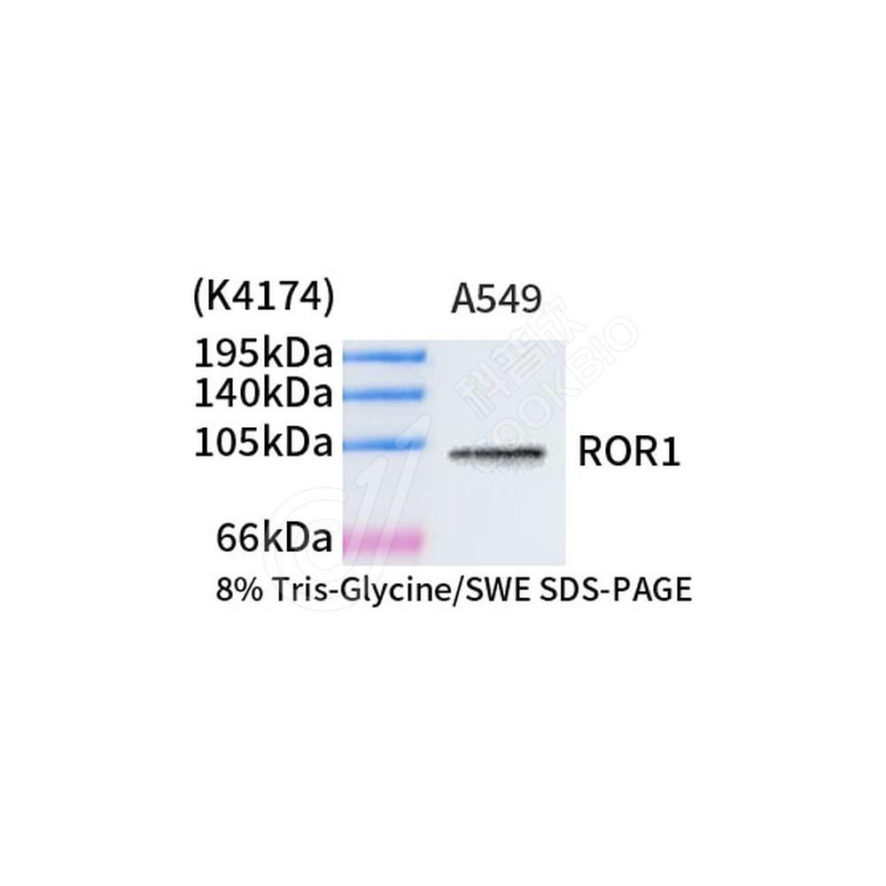 ROR1_d500_WB